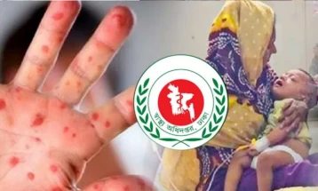 হাম উপসর্গে আরও ৩ মৃত্যু