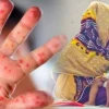 হামে প্রাণ গেল আরও ৮ জনের